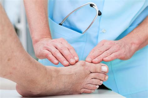 Bunion Deformity – Corrigan Podiatry