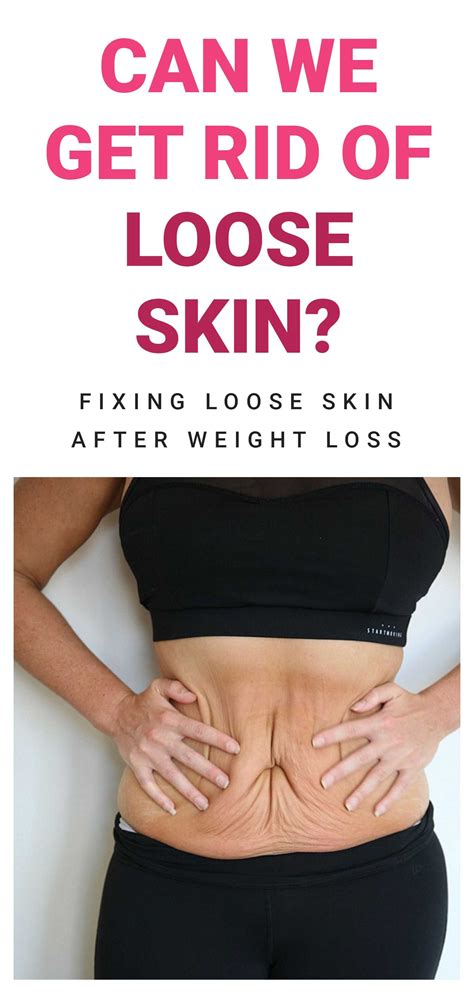 how to tighten the skin after weight loss 1
