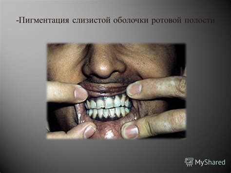 Презентация на тему: "Надпочечники. Заболевания надпочечников". Скачать ...
