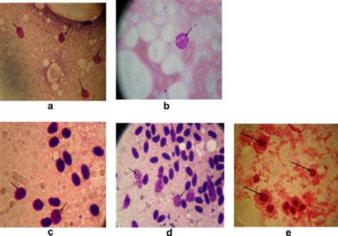 Chlamydial inclusion bodies in the impression smears. (a–d) Chlamydial ...