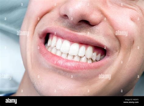 Perfect Teeth Smile Man