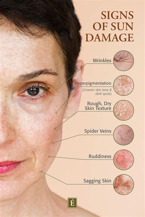 What Does Sun Damaged Skin Look Like? | Eminence Organic Skin Care