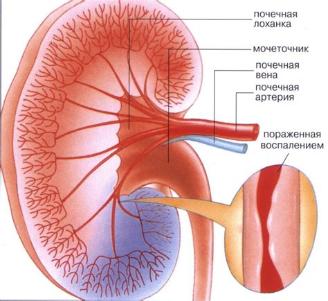 Почечная недостаточность: лечение, причины, симптомы