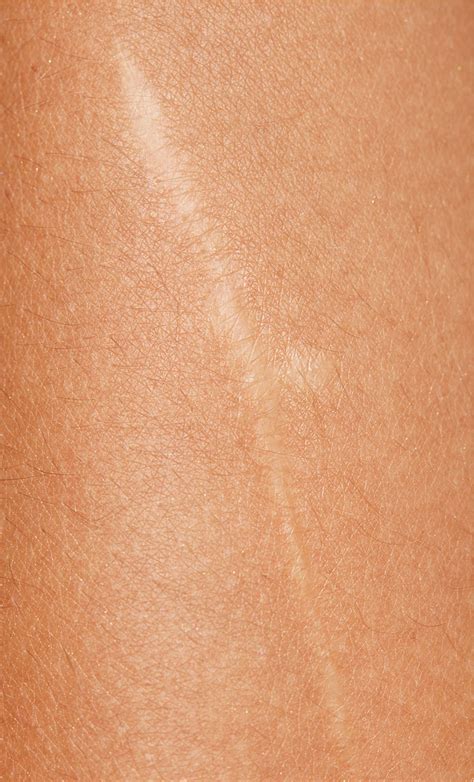 skin   elise dumontet