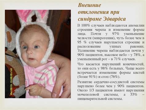 Синдром Эдвардса - презентация онлайн