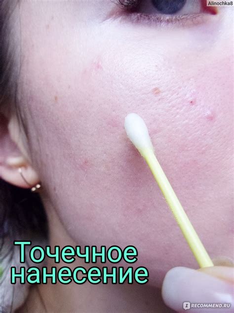 Пилинг лица фруктовыми кислотами - «Пилинг с кислотами: мои правила ...