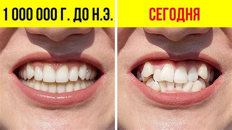 Почему у первобытных людей были идеально ровные зубы - YouTube