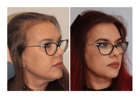 Jw Woodward: Before & After Results That Will Shock You Image 4