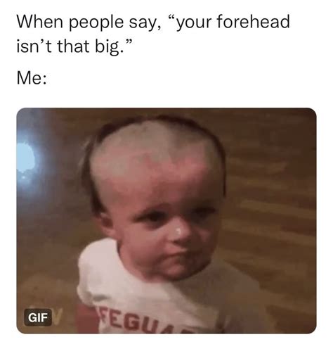 Big forehead meme | Big forehead, Forehead pictures, Forehead