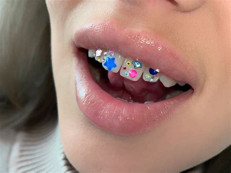 how to remove tooth gems at home