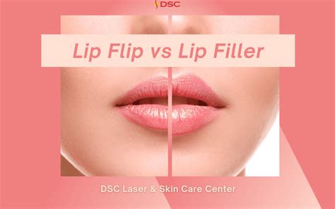 Lip Flip vs Lip Filler - DSC Laser & Skin Care Center