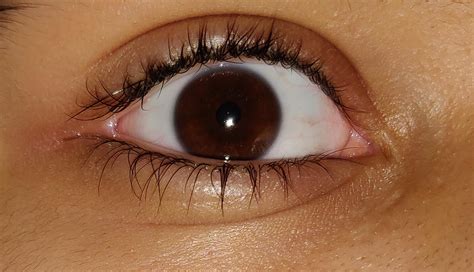 Been having a weird irritating medium pain in my left eye corner