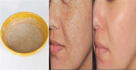 how to make face look younger home remedies