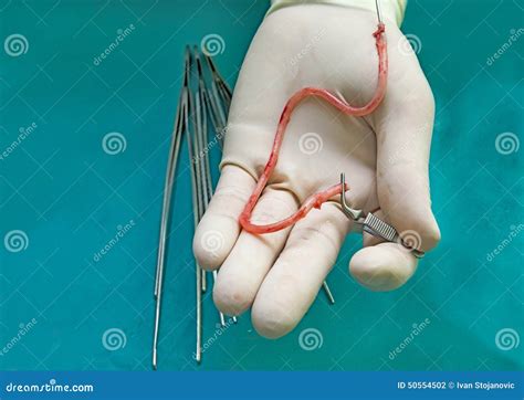 Vein graft stock photo. Image of vascular, surgery, heart - 50554502