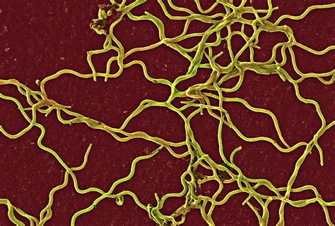 Borrelia Burgdorferi Bacteria Photograph by Ami Images/janice Haney ...