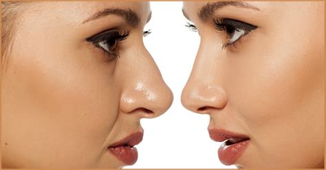 All different nose shapes - Hoptea