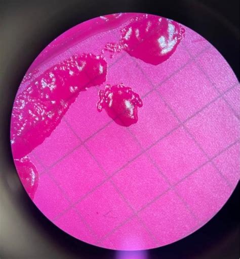 describe  appearance form margin elevation  cheggcom