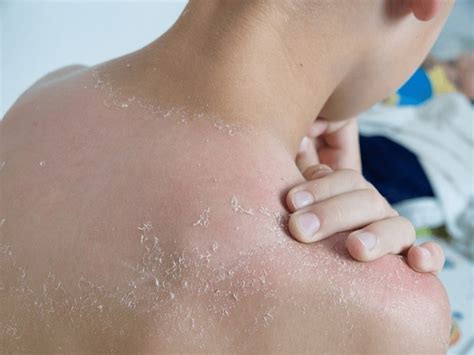 Dead Skin Off Royalty-Free Images, Stock Photos & Pictures | Shutterstock