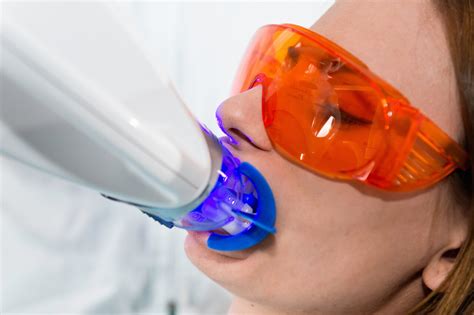 professional teeth whitening sopron hungary molnar dental