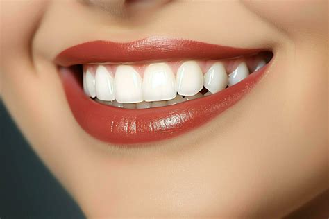 Perfect healthy teeth smile of a young woman at a dentist. Teeth
