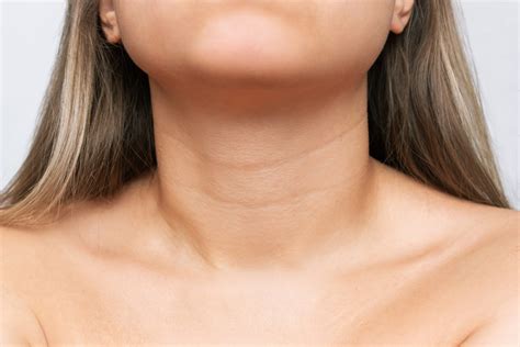 Reduce neck lines appearance with our treatments | SILKOR UAE