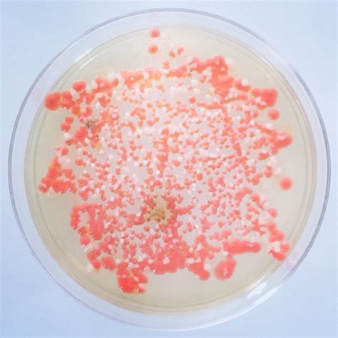 Serratia Marcescens Emb Agar Results 5