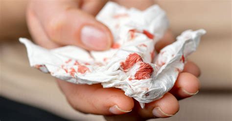 hemorrhage  emergency symptoms  aid