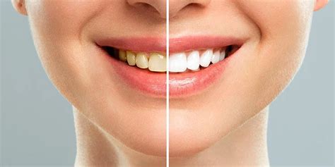 rid  yellow teeth easily fast stylepersuit