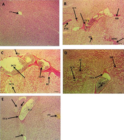 Histological sections of liver tissues exposed to acetaminophen. Female ...