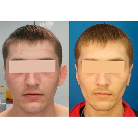 Пластика лица - Пластический хирург - Карапетян Георгий Эдуардович