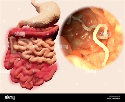 tapeworm infection  res stock photography  images alamy