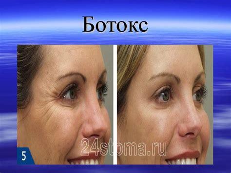 Пластикалық хирургия - презентация онлайн
