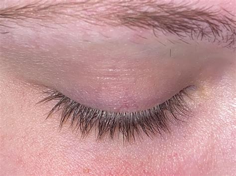 Does anybody have an idea as to why my eyelashes (and some brow hairs