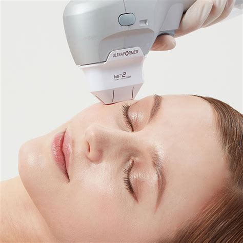 Ultraformer III Hollywood Lift – Skin Correctives