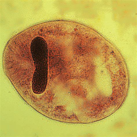 Balantidium coli. - Taller de Investigación. - Podcast en iVoox