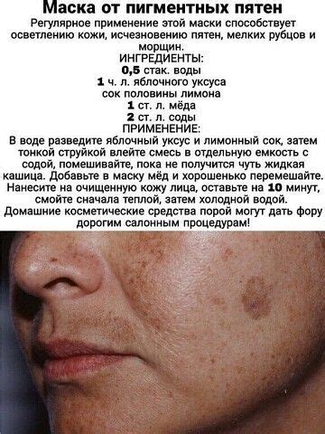 Маска от пигментных пятен | OK.RU | Gesundheit und schönheit ...