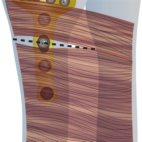 Illustration of PQ split. | Download Scientific Diagram