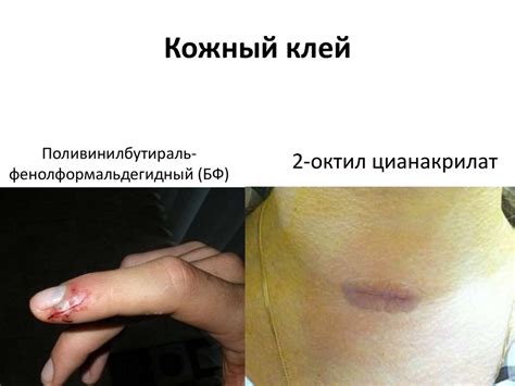 Раны и раневой процесс - презентация онлайн