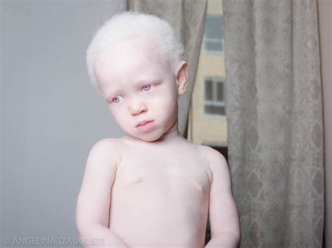 l'étrange beauté porcelaine des albinos par Yulia Taits | Pics ...