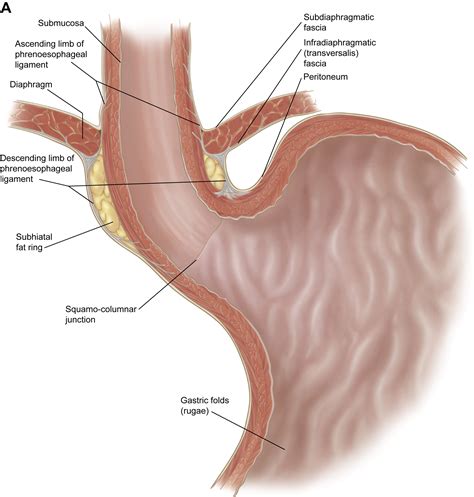 General Anatomy of the Esophagus - Thoracic Surgery Clinics
