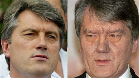 20-річчя отруєння Віктора Ющенка. Коротка історія застосування отрут ...