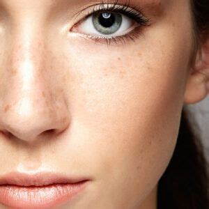 Skin Bleaching | DERMAdoctor Blog | Skin bleaching, Skin, Skin tones