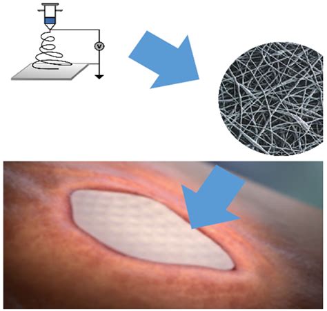 Matristem Wound Matrix – Matristem Wound Healing – UQJFK