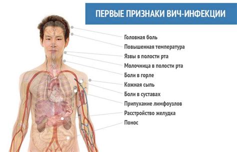 ВИЧ у женщин - причины, признаки, симптомы и лечение