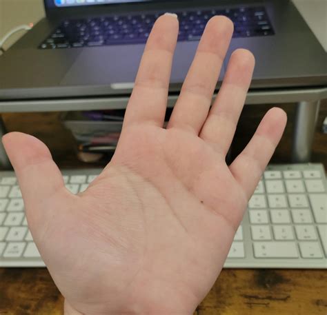 I have one small freckle on the palm of my hand : r/mildlyinteresting