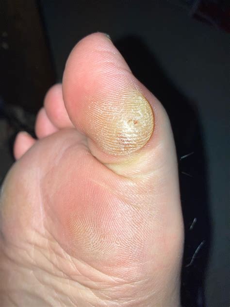 Big Toe Porn