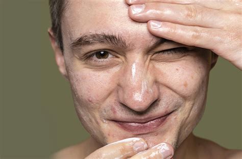 Скиноклир - крем и гель для наружного применения, цена, инструкция по ...