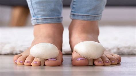 Avec seulement 2 ingrédients, il élimine les mycose des ongles des ...