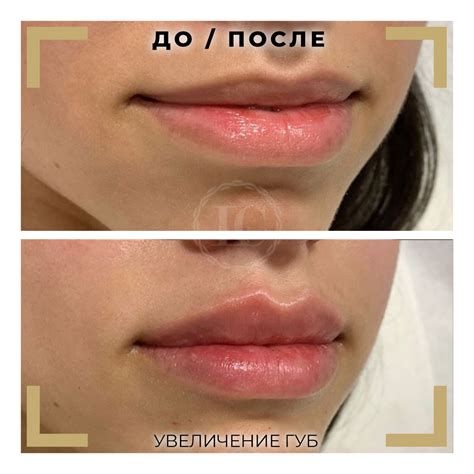 Виды поцелуев в губы и как их делать фото