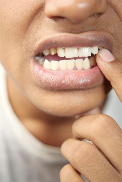 ¿Qué es salud Oral? | B & S